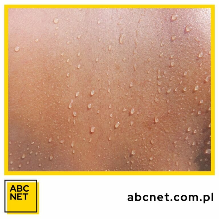 co jeść, by mieć zdrową cerę dieta na zdrową i piękną skórę.