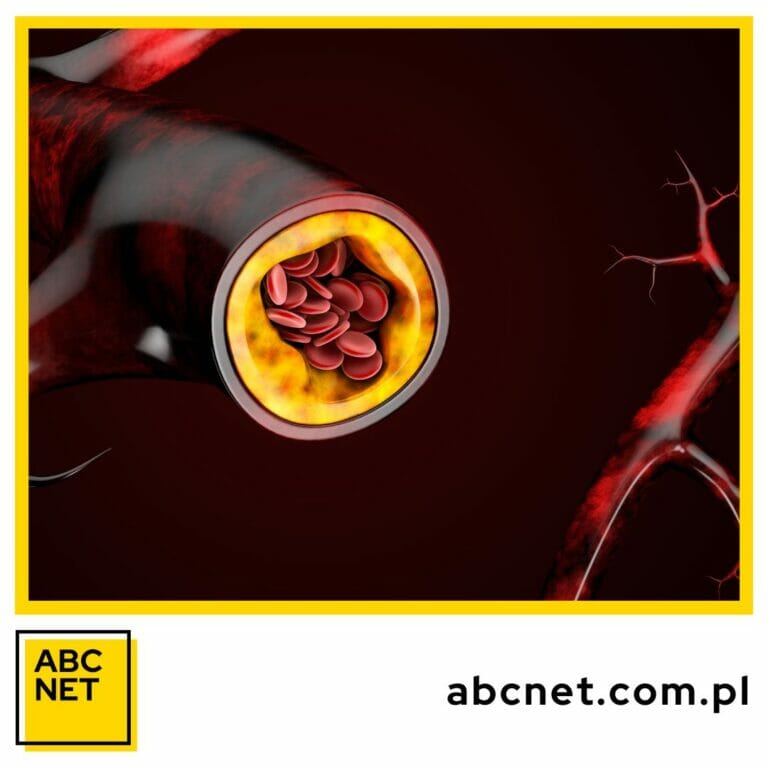 dieta na cholesterol