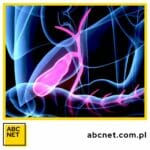 dieta na trzustkę. co to jest dieta na trzustkę