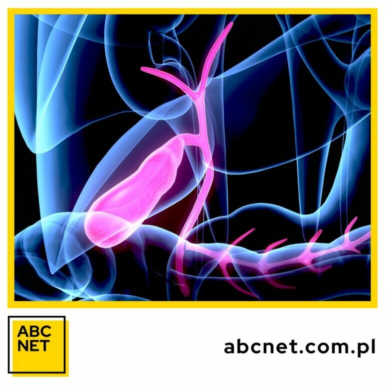 dieta na trzustkę. co to jest dieta na trzustkę