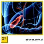 dieta na woreczek Żółciowy