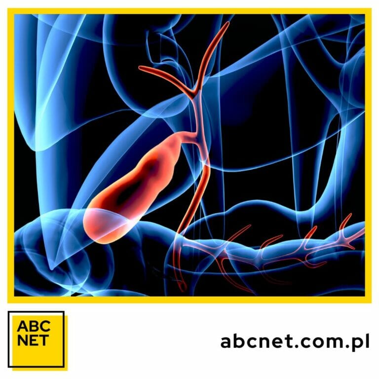 dieta na woreczek Żółciowy