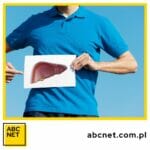 stłuszczenie wątroby dieta. co to jest stłuszczenie wątroby dieta