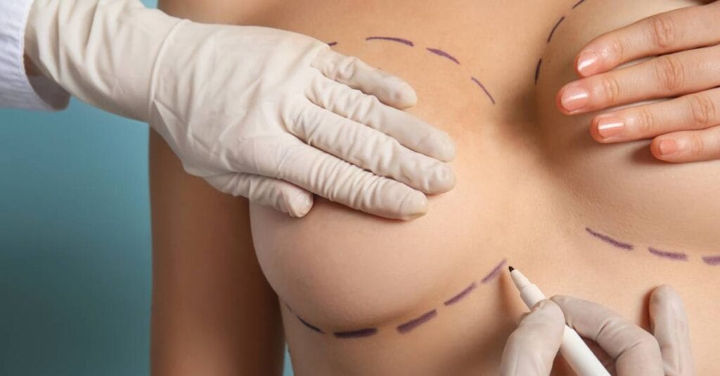 rozmiar piersi operacja